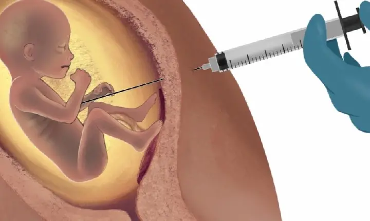 Câmara aprova urgência de projeto que equipara aborto ao crime de homicídio mesmo em casos de estupro