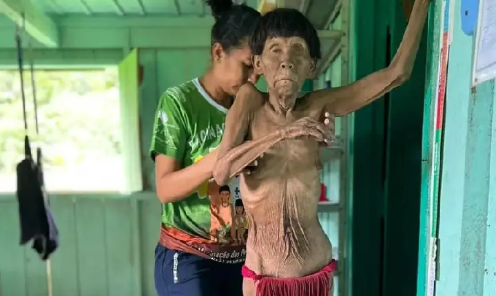 ONG recebe R$ 15,8 milhões do governo Lula para ações em terra Yanomami