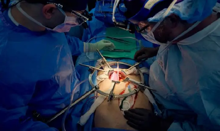 Paciente nos EUA vive há mais de um mês com o rim de um porco