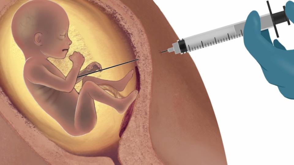 Câmara aprova urgência de projeto que equipara aborto ao crime de homicídio mesmo em casos de estupro